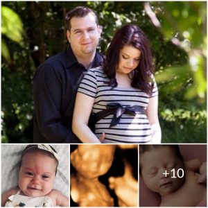 Against All Odds: The Remarkable Story of a Mother with No Arms Giving Birth to a Beautiful Baby
