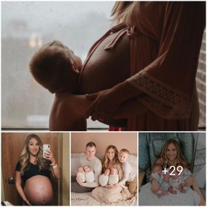 The Realities of Motherhood: Mom’s Brutally Honest Before and After Photos of Quadruplet Birth