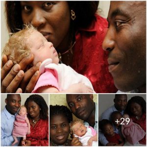 Challenging Expectations: The Story of a Black Couple’s Unusual White Baby