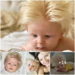 The Talk of the Town: A Baby Born with a Full Head of Blond Hair Captivates Everyone