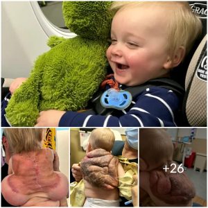 Breaking the stigma: A mother’s story of love and acceptance for her ‘shell baby’