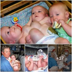 The Unbreakable Bond: The Story of the Conjoined Triplets