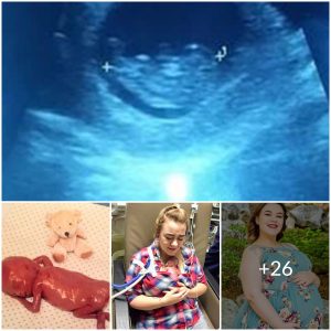 A Brave Mother Decided To Carry Quadruplets Even Though She Knew Only One Would Survive
