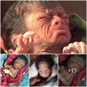 A Baby Like No Other: Indian Infant’s Unusual Appearance Shocks the World
