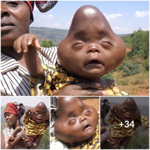 Triangle-headed baby born to stunned mother, prompts questions about genetic abnormalities