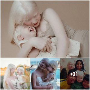 Strange Beauty: Two Albino Sisters With 12 Years Difference Successfully Become Models
