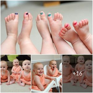 The triplets and their technicolor toes: a unique solution to a common problem