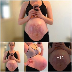 Incredible Detail: Viral Pregnancy Photos Show the Beauty and Reality of Stretch Marks
