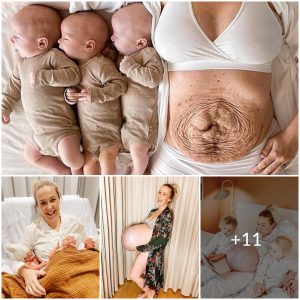 Triple the Blessings, Triple the Pain: A Mother’s Account of Giving Birth to Triplets