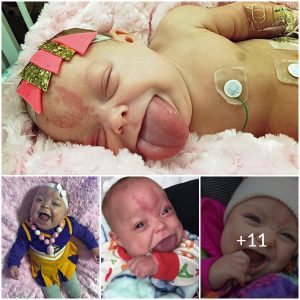 The Heartwarming Story of a Baby’s Triumph Over Adversity