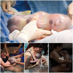 The Magic of Birth: 10 Extraordinary Photos of Babies Born in the Amniotic Sac