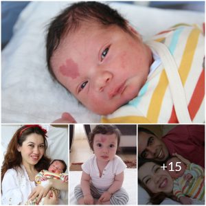 A Beautiful Blessing: Baby Boy Born With Heart-Shaped Birthmark Brings Joy To Family