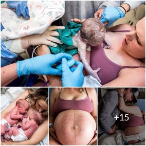 A Double Miracle: Beautiful Photos of Twin Births That Will Melt Your Heart