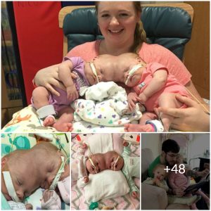 Together and Apart: The Inspiring Story of the Conjoined Twins Who Found Freedom