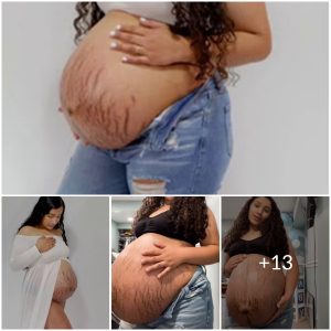 Beyond the Bump: Revealing the Reality of Pregnancy through Candid Emotions