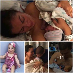 The Miracle of Birth: A Mother’s Journey with a Child Diagnosed with Treacher Collins Syndrome