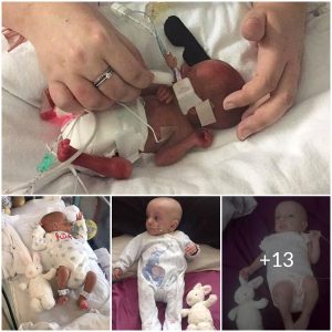 From Tennis Ball to Toddler: The Inspiring Story of a Premature Baby Girl