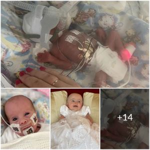 The Power of Perseverance: A One-Year-Old’s Triumph Over Prematurity