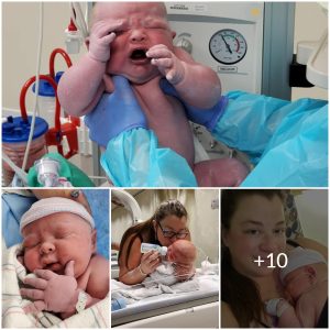 Bigger Than Average: Newborn Baby Sets Record Weight at 6.3 Kilos