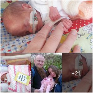 Against All Odds: Premature Baby Smaller Than Mother’s Wedding Ring Beats the Odds