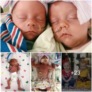 A Sister’s Instinct: Twin Sends ‘Distress Signal’ to Save Sibling’s Life