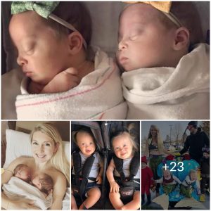 Celebrating Differences: Family Embraces Identical Twins with Down Syndrome