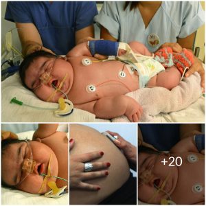 The Heaviest Newborn: Celebrating a Rare and Remarkable Birth