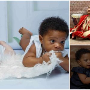 The twins are identical, but they have different black and white skin tones.