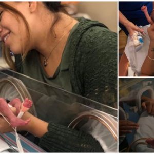 The Premature Baby With Survival Rate Was Only 1% Fighting For Life And The Miracle After One Yeɑr