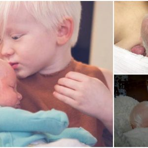 The boy who was just born with a different hair color was dubbed the “White-haired Prince”(VIDEO)