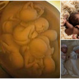 If you’ve ever wondered what it looks like to be pregnant with multiρles, this is the beauty of it.