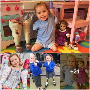 Brave Girl Who Lost All Her Limbs Has The First Day At School  Nervous