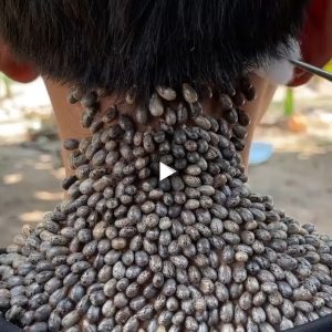The Terrifying True Story of the Man Covered in Thousands of Ticks