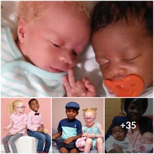 What did the mother of 1 black 1 white twins say when the public did not believe the truth
