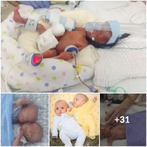 Too Young to Give Up: The Remarkable Tale of Twins Who Survived Against All Predictions