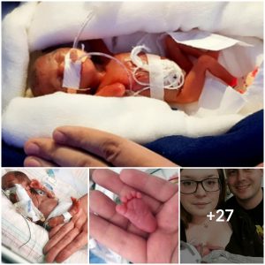 Dubbed ‘The Little Fighter’ by Doctors, Young Girl’s Resilience Shines Through