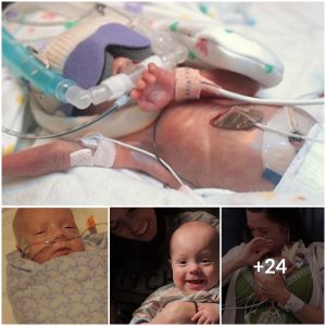 From Darkness to Light: 5.5-Month-Old Baby’s Struggle to See the World Outside